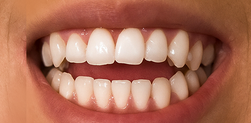 Antes Clinica Cehom resultados