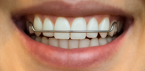 Depois Clinica Cehom resultados