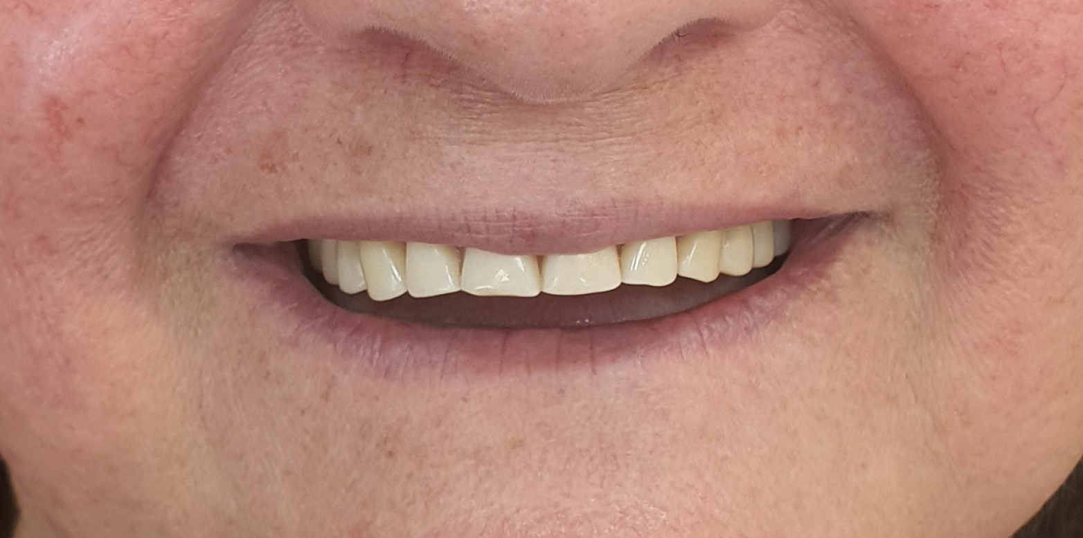 Cópia de IMG_20230321_104126 2